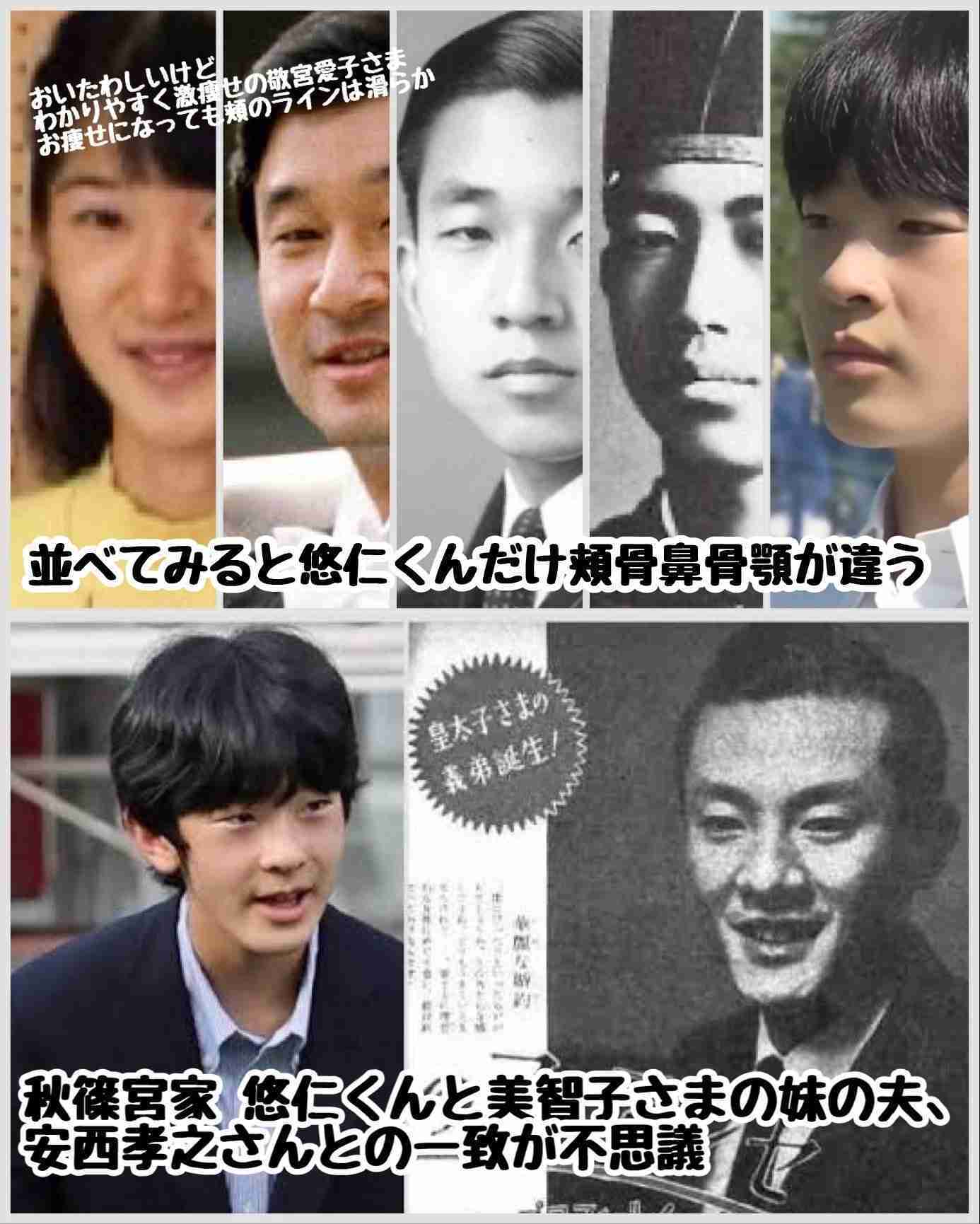 比較されがちなこと