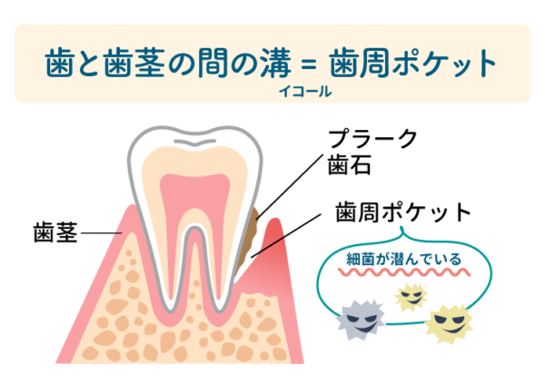 30代、歯周病治療中の方いますか?