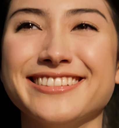顔の左右差を治したい