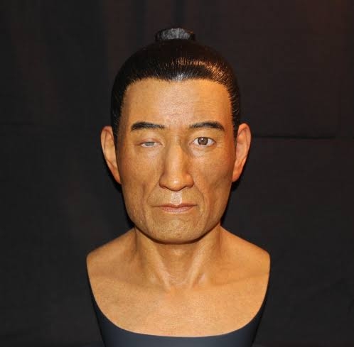 顔の左右差を治したい