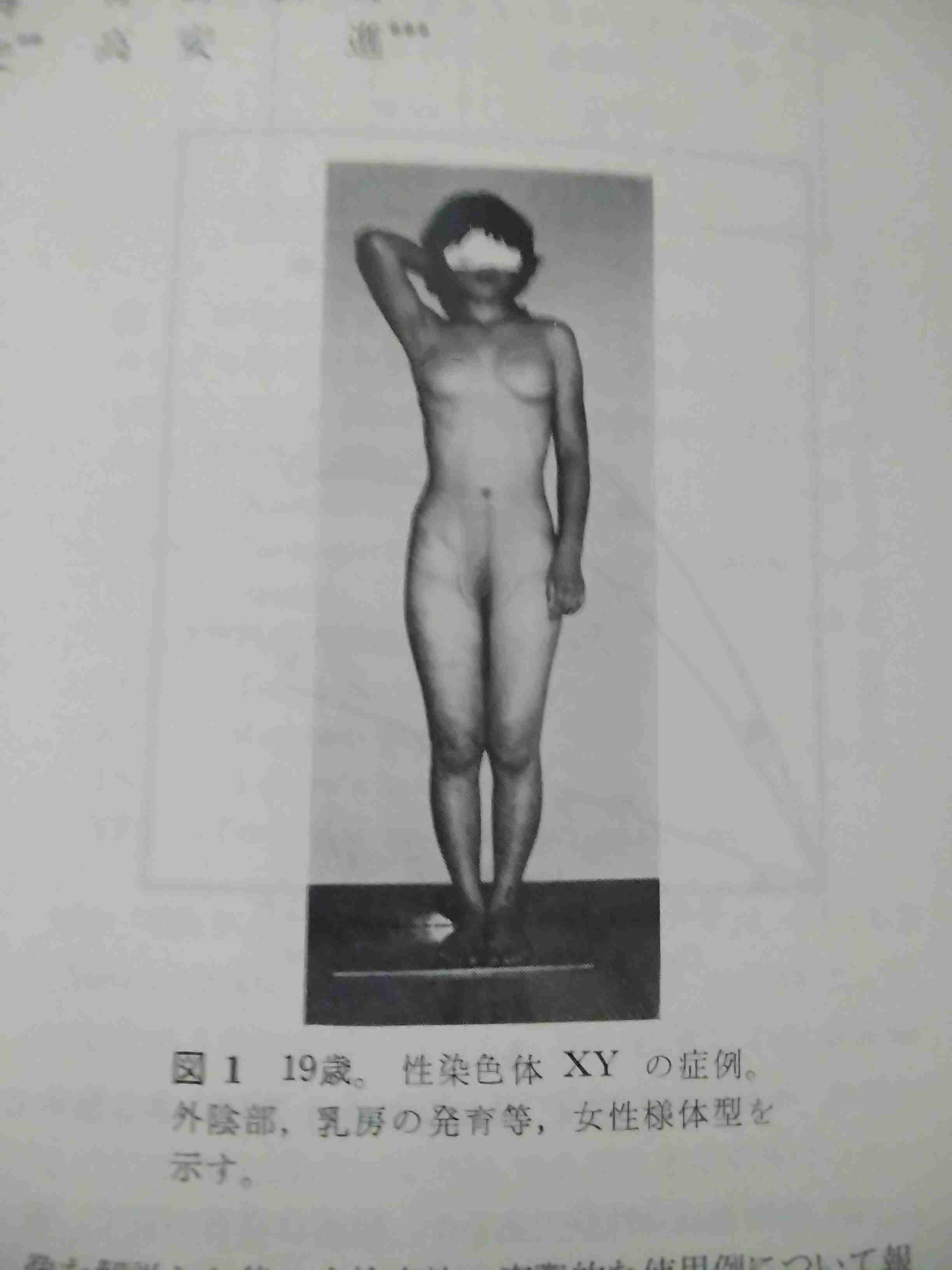 「トランス女性」全寮制・女子大が受け入れ方針で物議…当事者「寮生活だと24時間おびえないといけない」