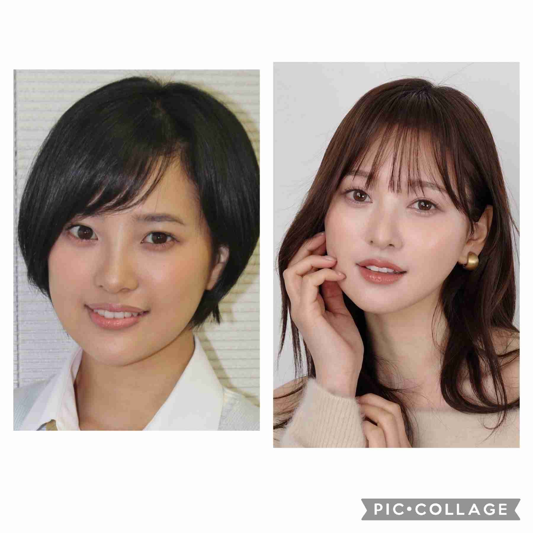 兒玉遥「ヒアルロン酸溶かして正解」ビフォーアフター公開に反響「綺麗」「勇気ある決断」