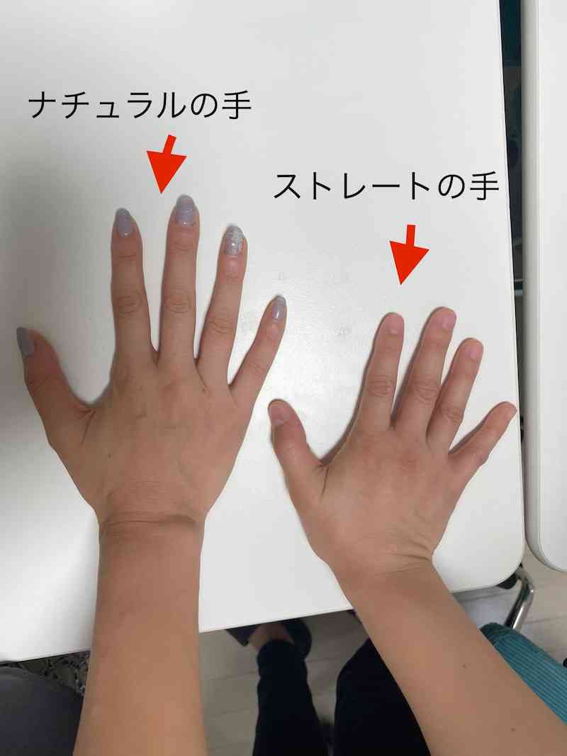 親指の長さ、脳の大きさとの関連性が判明　骨格成長に関わる遺伝子が幼少期の脳発達にも関与　ドイツ研究