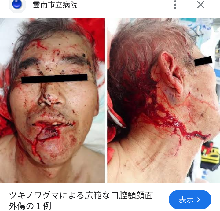 「熊の命を奪うな」「山に返してやれ」に地方在住の編集者が眉をしかめる理由…「害獣を駆除しなければ野菜が食べられなくなる」