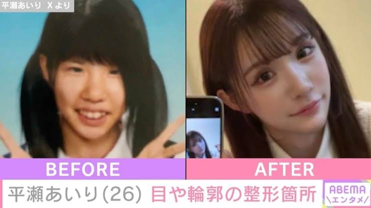 高須克弥院長が謝罪、整形総額2600万円のモデルの“前後”写真に「嘘つき!」投稿の経緯説明