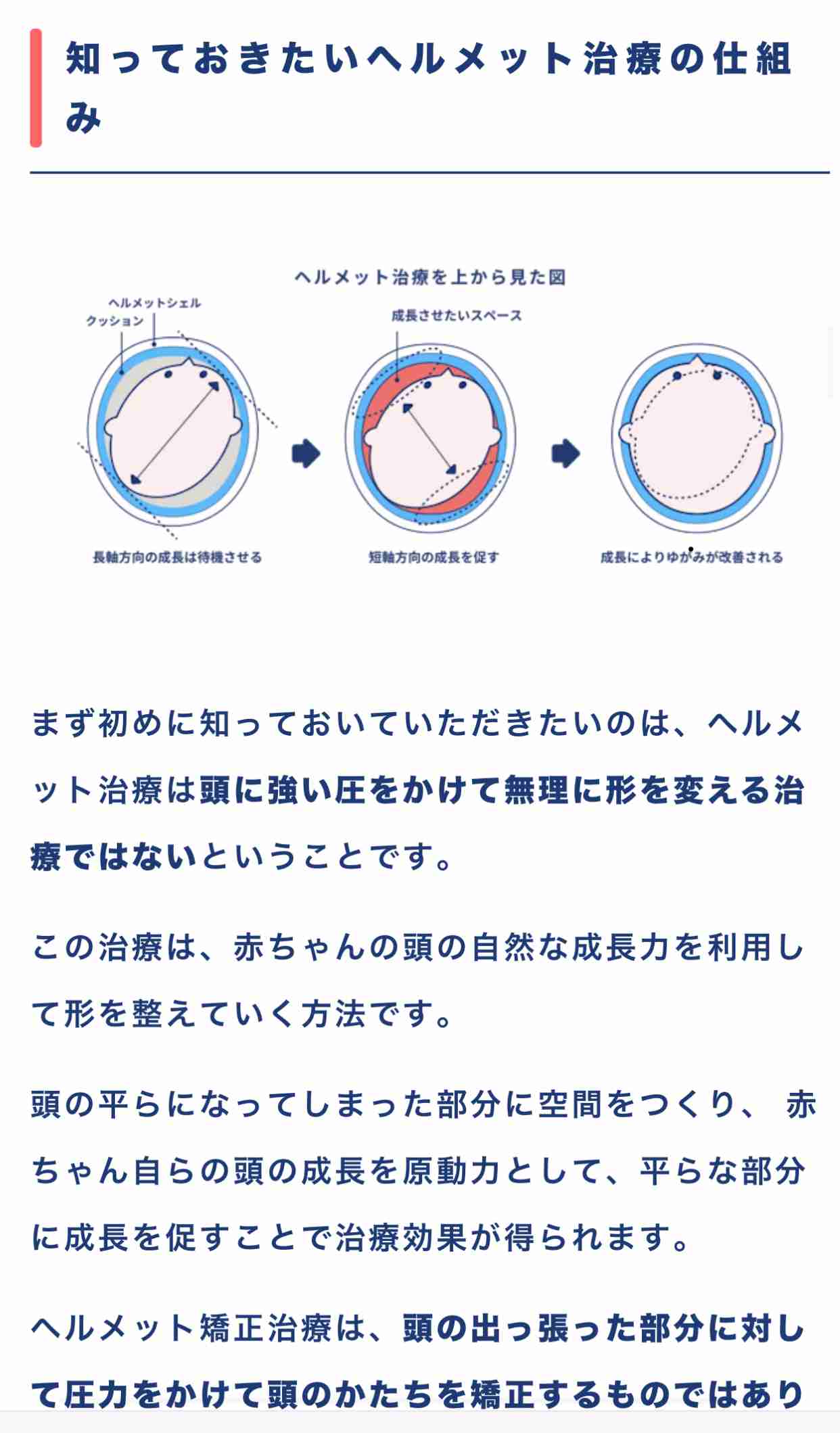 赤ちゃんのヘルメット治療が物議…“親心”が子のルッキズムを助長?高須幹弥院長「責任を感じて『治してあげたい』気持ちはわからなくもない」