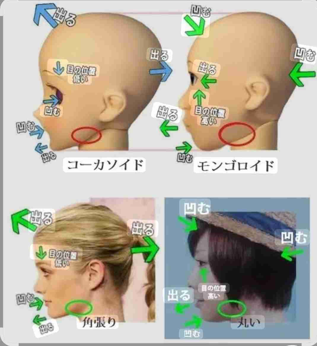 赤ちゃんのヘルメット治療が物議…“親心”が子のルッキズムを助長?高須幹弥院長「責任を感じて『治してあげたい』気持ちはわからなくもない」