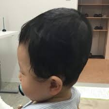 赤ちゃんのヘルメット治療が物議…“親心”が子のルッキズムを助長?高須幹弥院長「責任を感じて『治してあげたい』気持ちはわからなくもない」