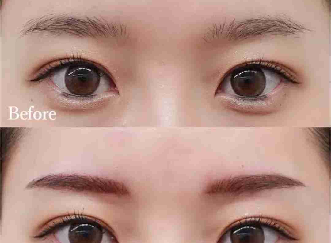 アートメイク人気の裏で“ヤミ看護師”が行う違法施術が激増、値段は3分の１以下…「場所はクリニックと違うから気をつけて」被害女性が語る実態