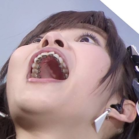 歯列矯正は整形に入ると思いますか?