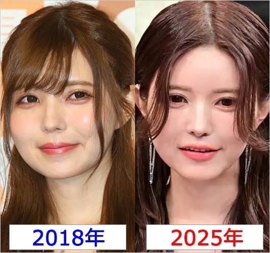 益若つばさ、芸能人の美容整形分析動画に警鐘 一般の子は「踊らされちゃってるなって」