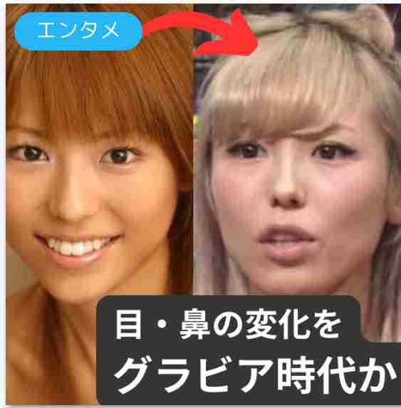 益若つばさ、芸能人の美容整形分析動画に警鐘 一般の子は「踊らされちゃってるなって」