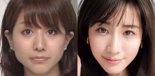 益若つばさ、芸能人の美容整形分析動画に警鐘 一般の子は「踊らされちゃってるなって」