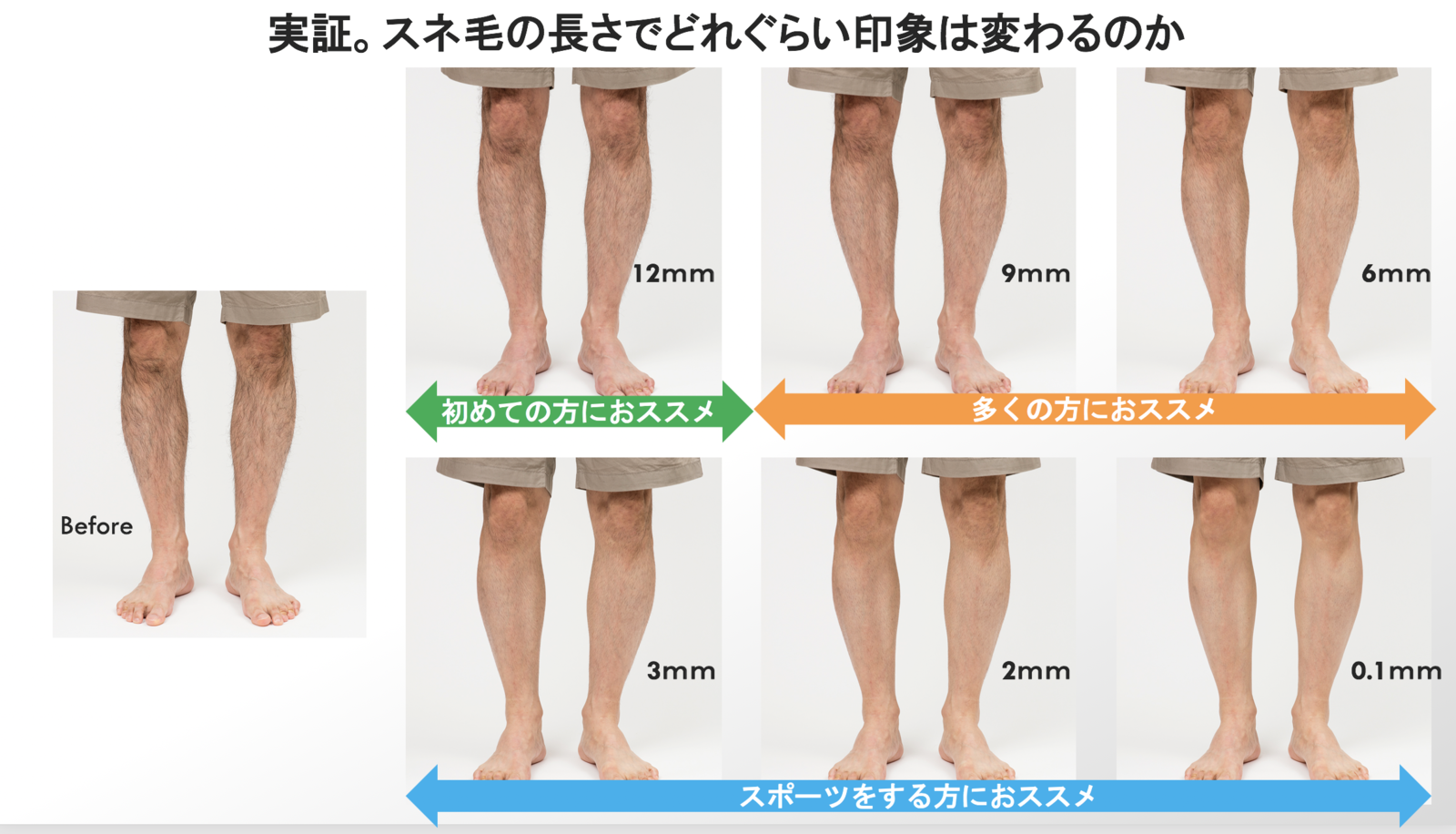 【賛否】短パン男性は《すね毛》を剃るべきなのか? SNS「すね毛キモい」「汚くて不快」相次ぐも「気にならない」擁護派も