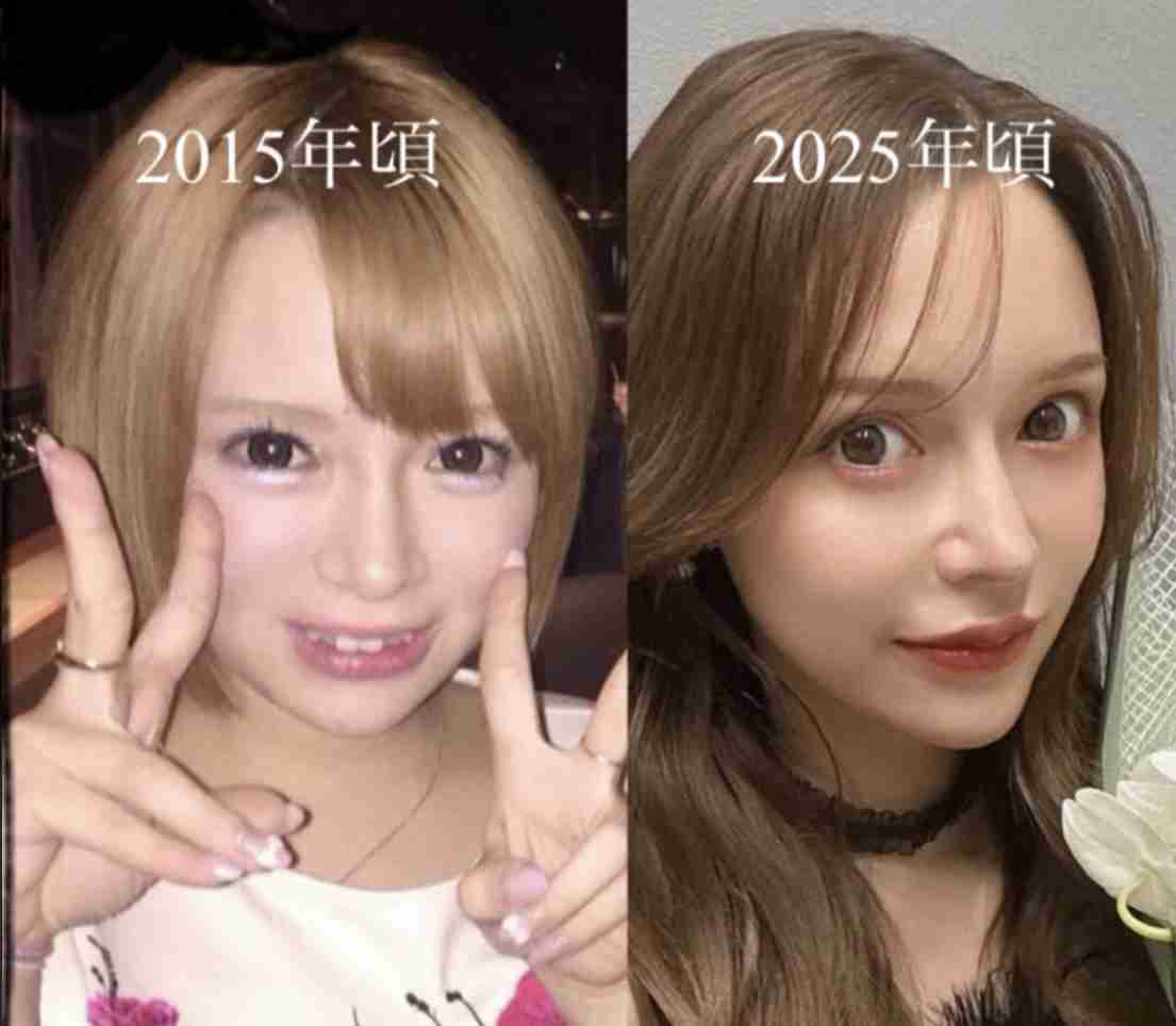 進撃のノア、夫ヒカルの“オープンマリッジ”宣言に本音吐露 「子どもを産みたくないとは思った」