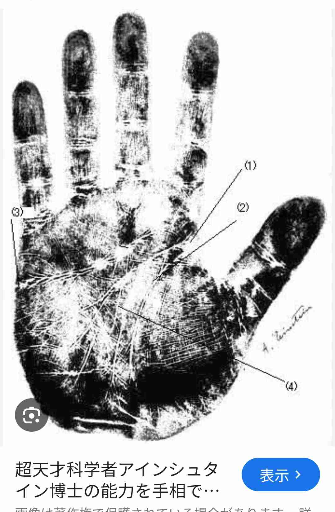 親指の長さ、脳の大きさとの関連性が判明　骨格成長に関わる遺伝子が幼少期の脳発達にも関与　ドイツ研究