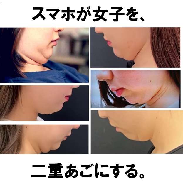あご肉の落とし方