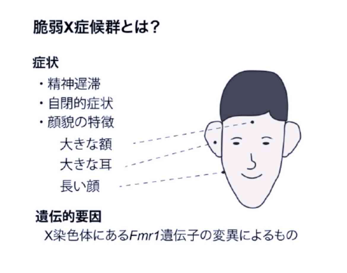 《エプスタイン事件の“悪魔の館”内部写真が公開》「官能的な芸術品が壁にびっしり」「一室が歯科医院に改造されていた」10代少女らが被害に遭った異様な被害現場　