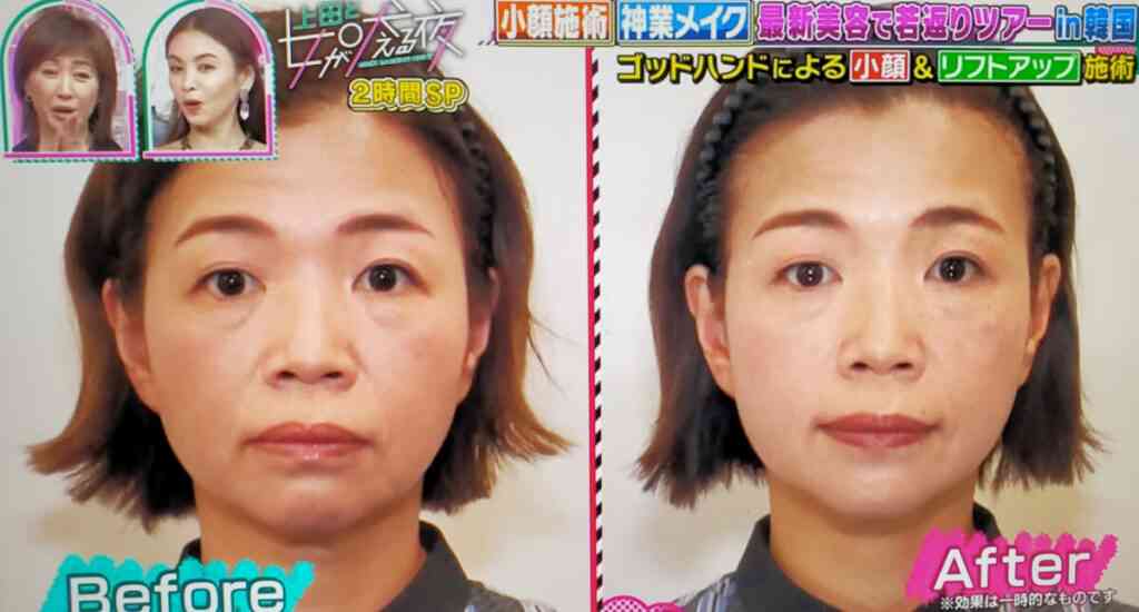 顔面無課金の方いますか?