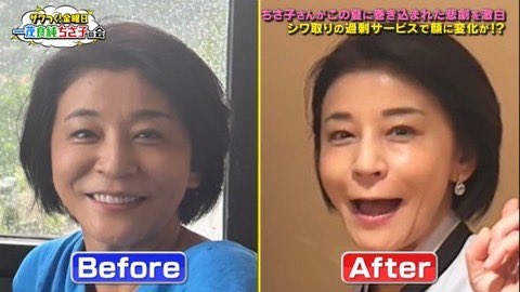 年齢が行ってから美容整形した方！