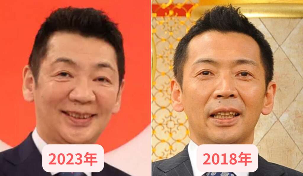 年齢が行ってから美容整形した方！