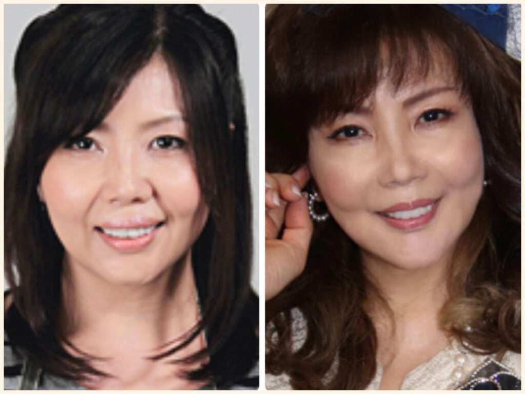 年齢が行ってから美容整形した方！