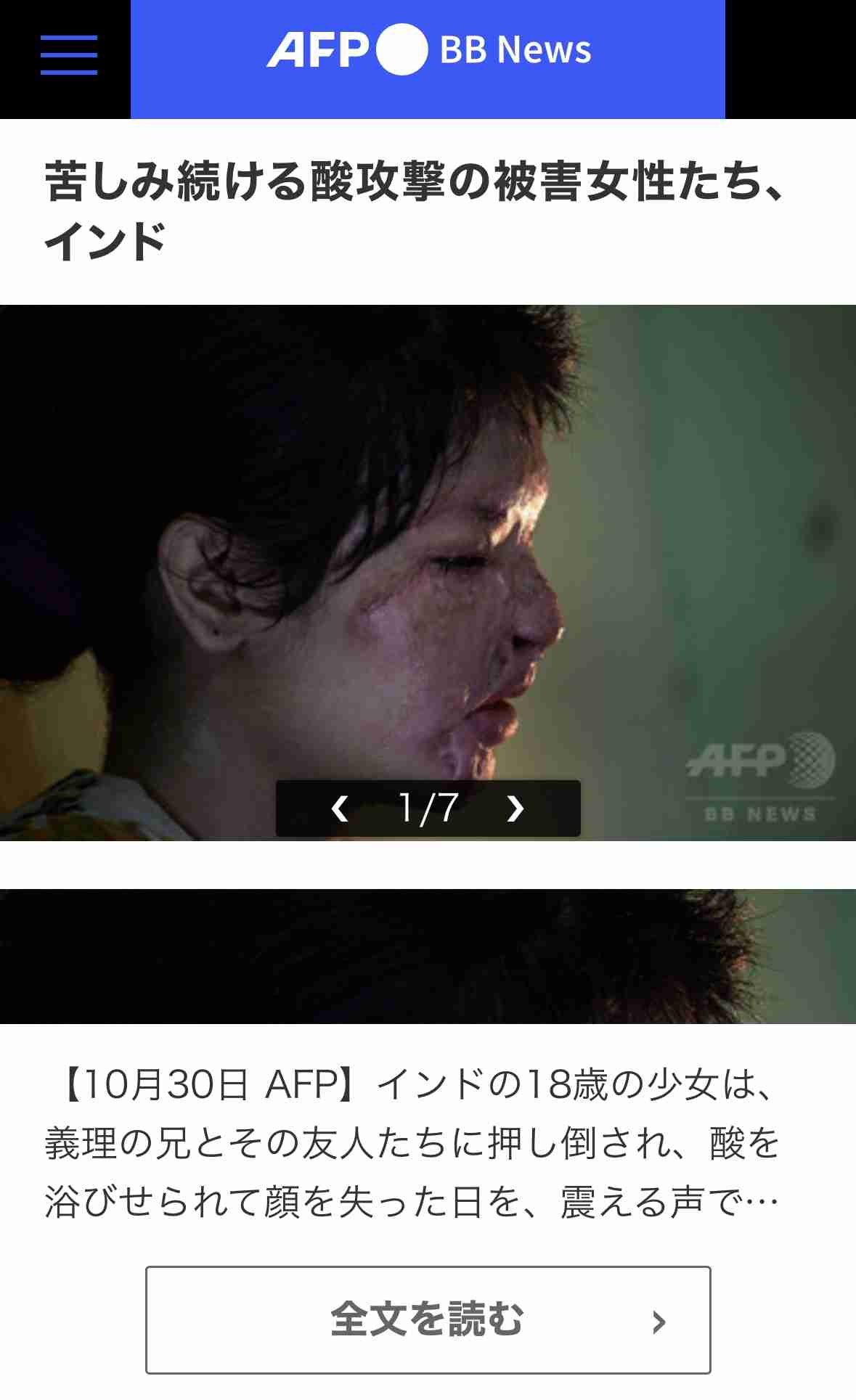 外国人受け入れ「スピードとペースの調整を」鈴木法相インタビュー