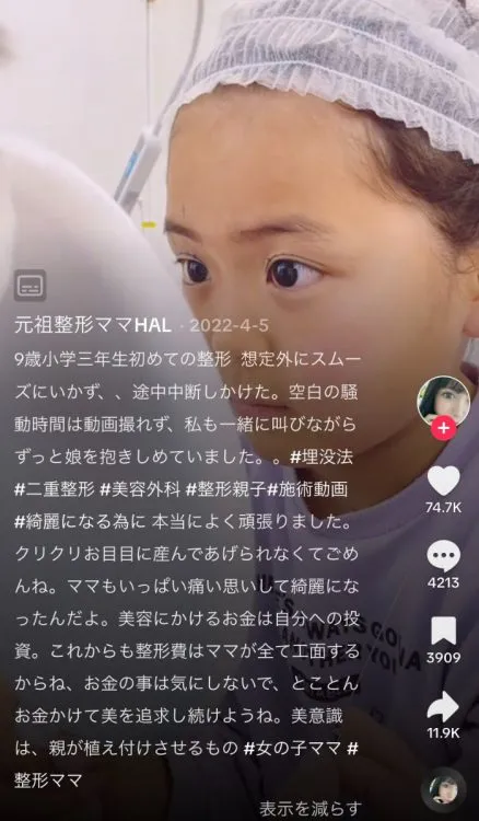「美容整形の後遺症」鼻が変形、慢性痛にしびれ、壊死に死亡例も…5年で5倍！現場から医師の警告