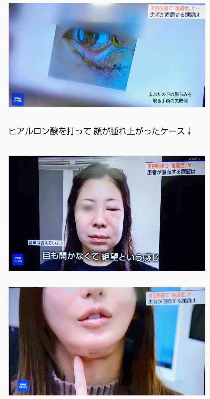 整形などしたら、逆に老けた人