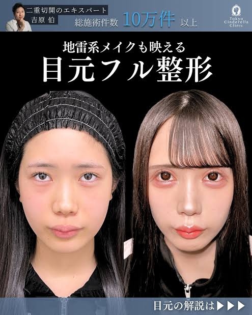 整形などしたら、逆に老けた人