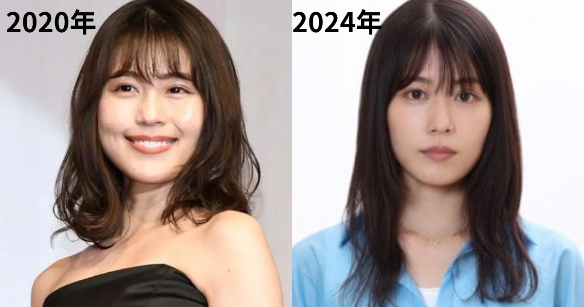 整形などしたら、逆に老けた人