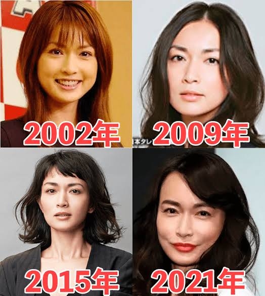 整形などしたら、逆に老けた人