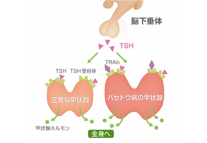 甲状腺の病気全般のトピ