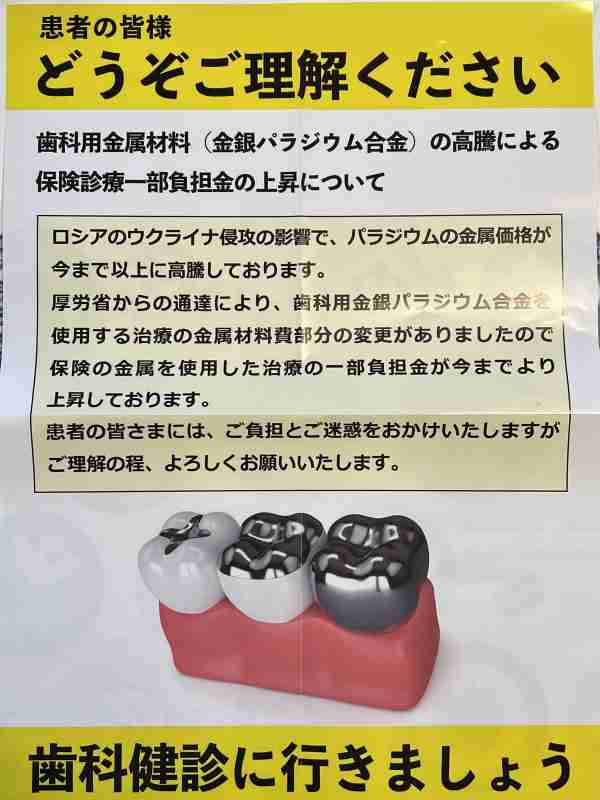 金だけではない貴金属高騰　銀が一時50ドル突破、1980年以来の高値