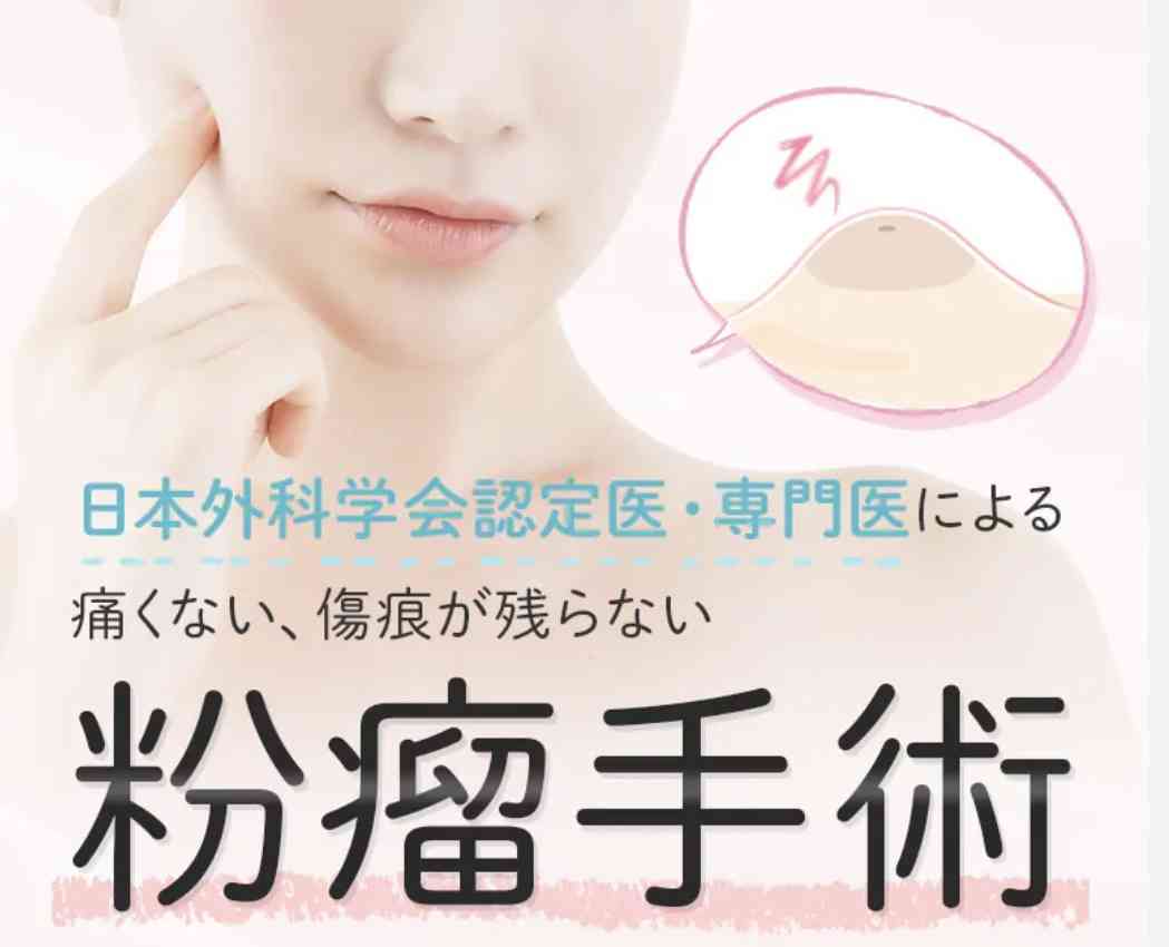 粉瘤できたことある人