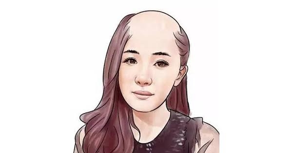 抜け毛が多すぎる