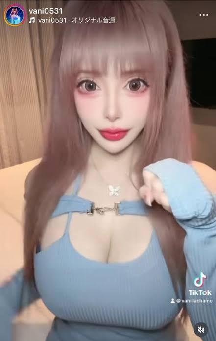 総額は3億5000万円！　整形美女・ヴァニラが明かす“トラウマ級”の凄絶手術　「頭皮をめくって人工の骨をおでこに…」　脂肪を溶かす注射は「月に200万円かかる」