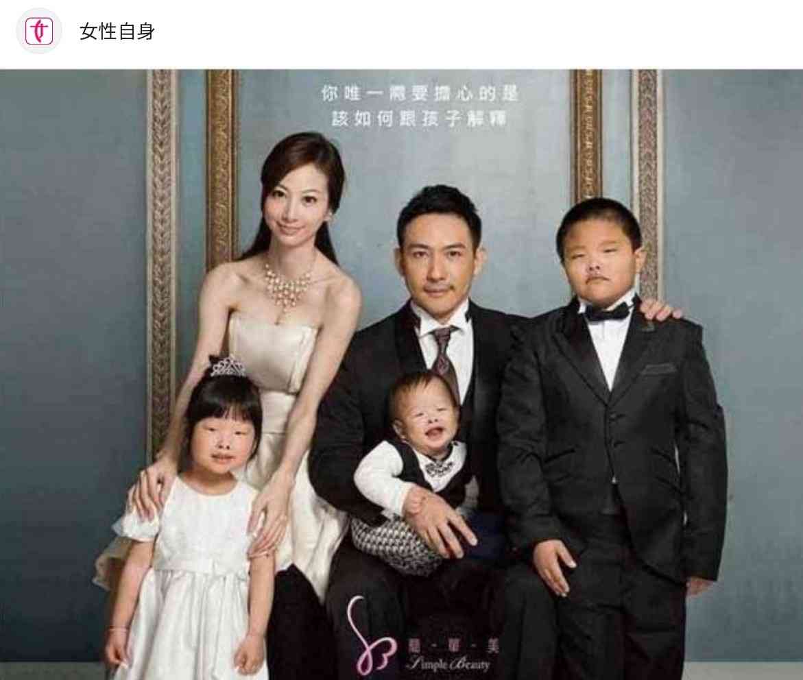 総額は3億5000万円！　整形美女・ヴァニラが明かす“トラウマ級”の凄絶手術　「頭皮をめくって人工の骨をおでこに…」　脂肪を溶かす注射は「月に200万円かかる」