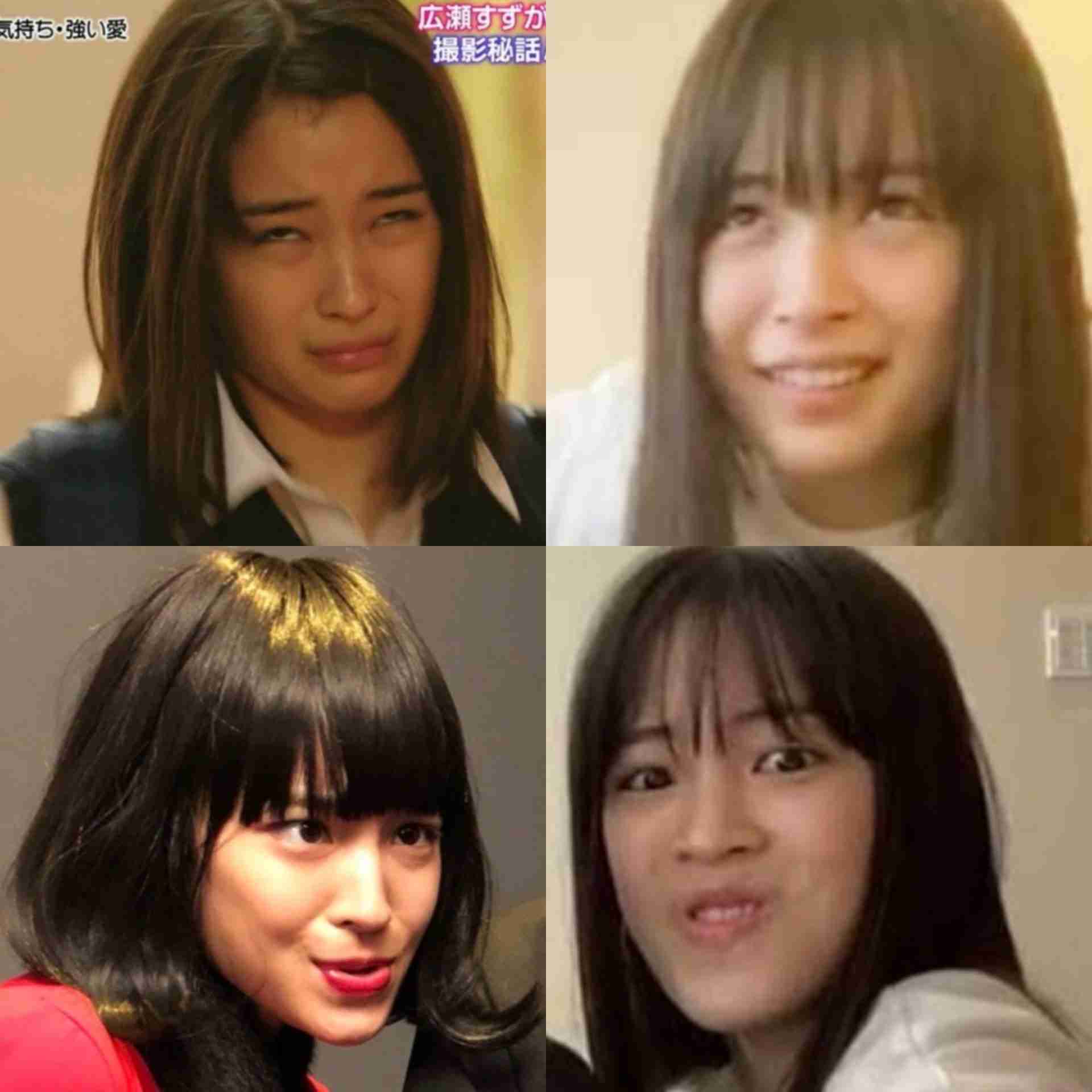 総額は3億5000万円！　整形美女・ヴァニラが明かす“トラウマ級”の凄絶手術　「頭皮をめくって人工の骨をおでこに…」　脂肪を溶かす注射は「月に200万円かかる」