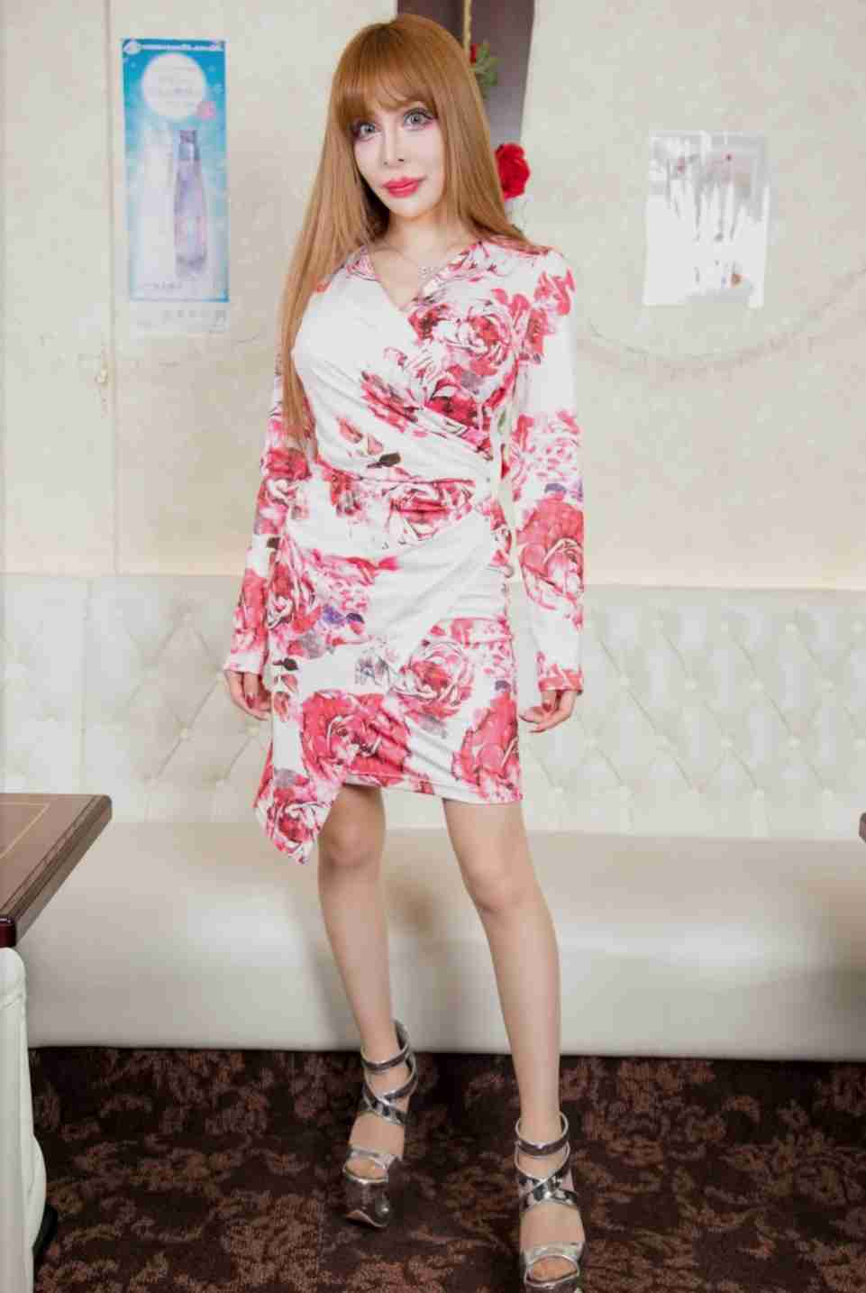 総額は3億5000万円！　整形美女・ヴァニラが明かす“トラウマ級”の凄絶手術　「頭皮をめくって人工の骨をおでこに…」　脂肪を溶かす注射は「月に200万円かかる」