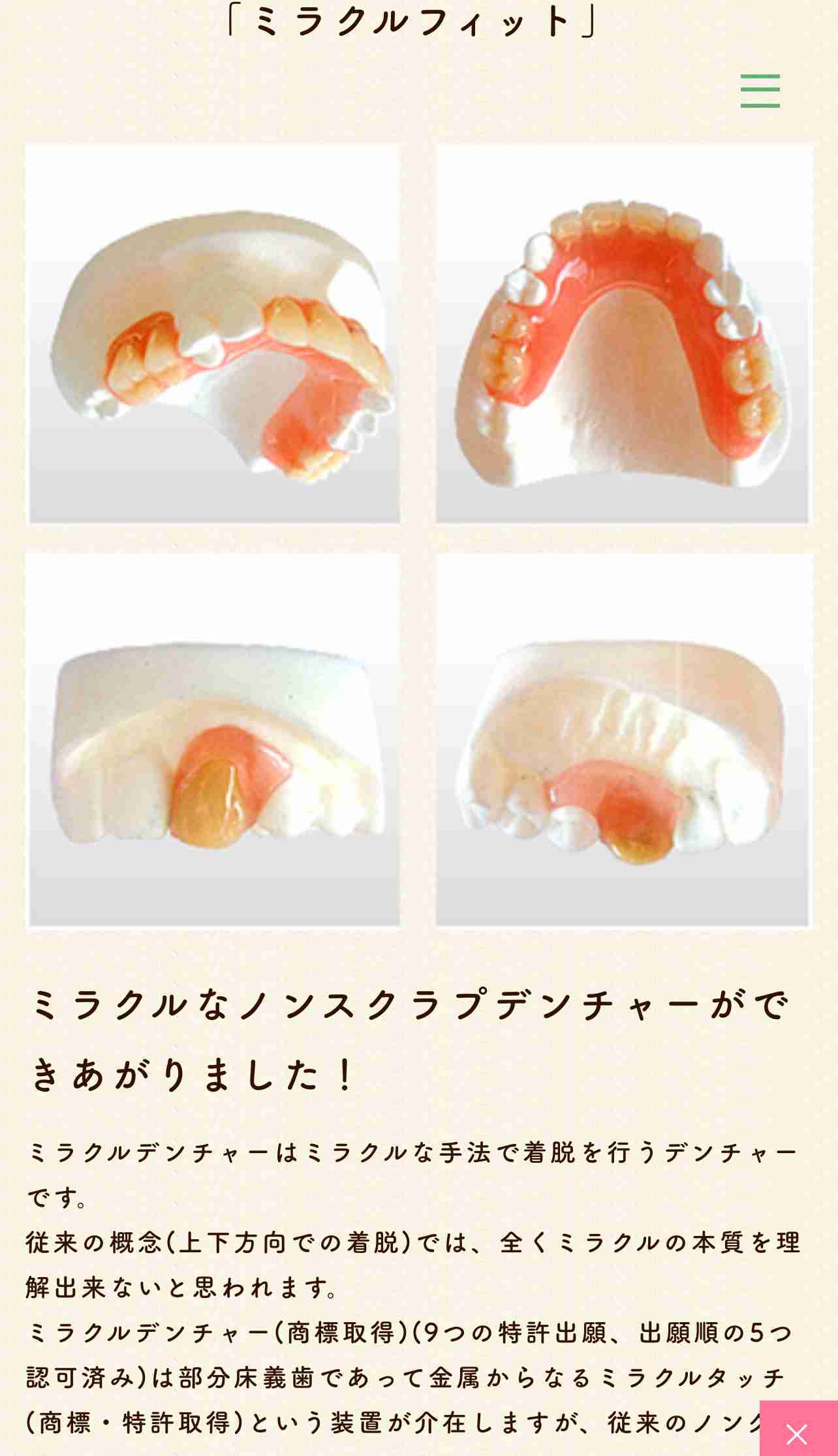 【歯】インプラント、ブリッジ、入れ歯、選択するなら?