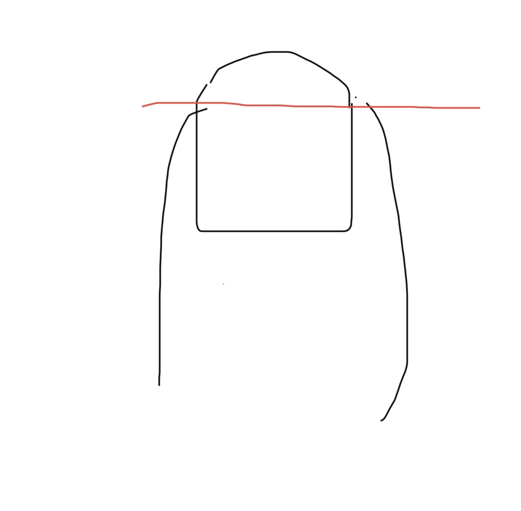 病院に行くほどじゃないけど困っている体の不調