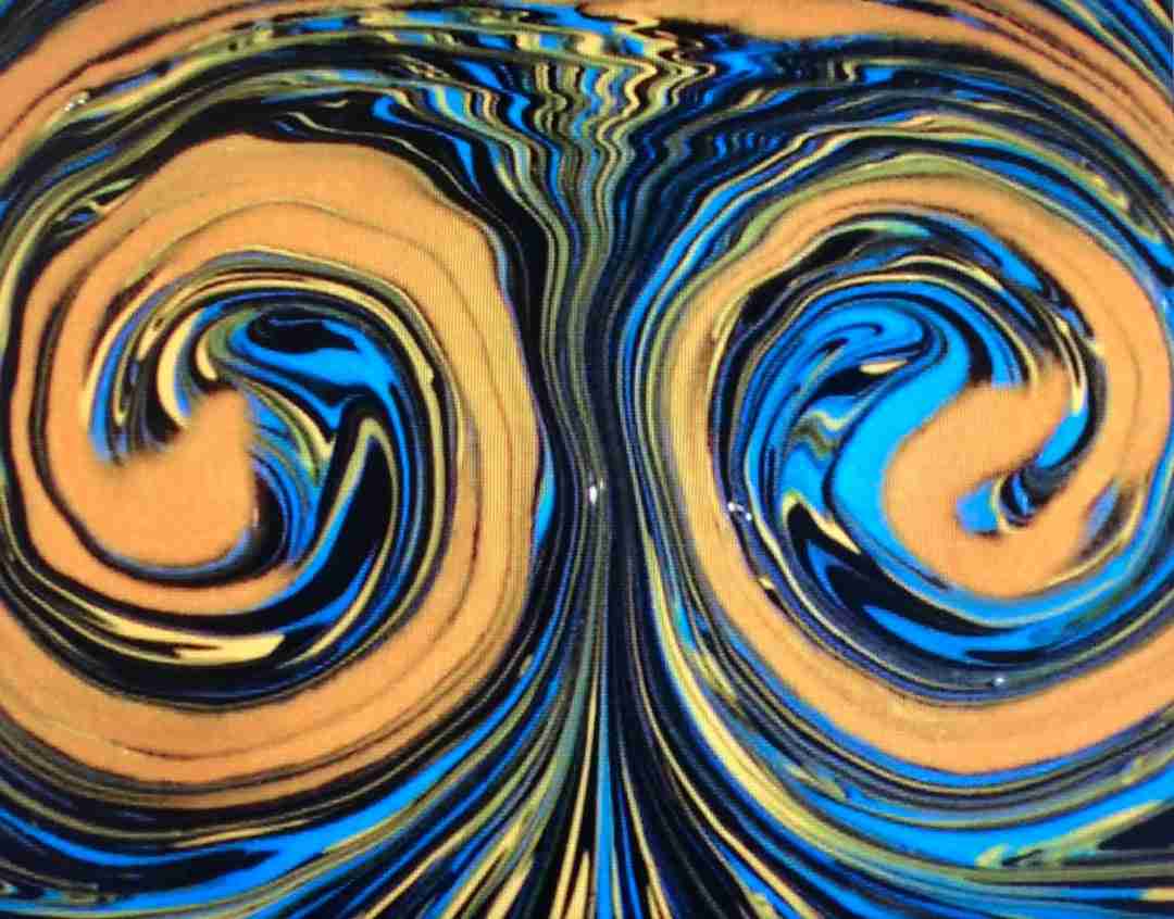 麻酔の経験を話してほしい！