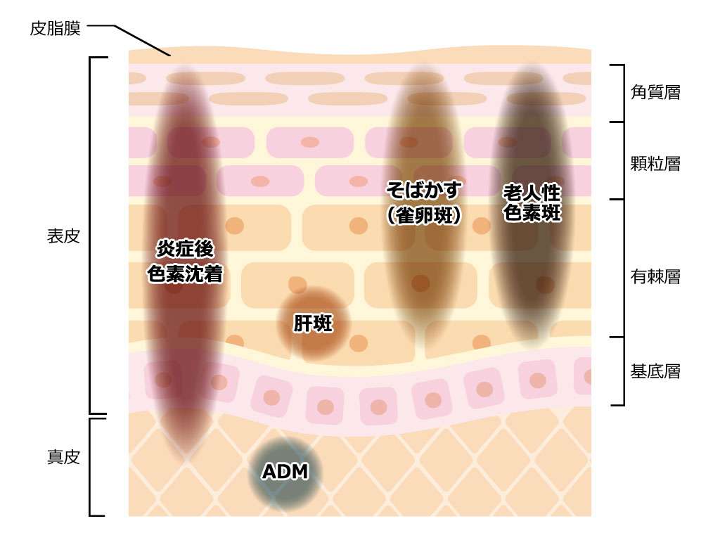 美容医療総合2【雑談】