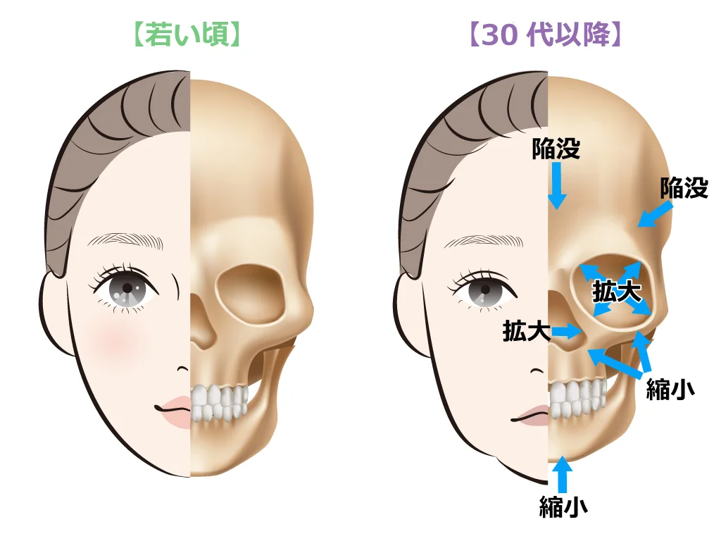 顔のたるみが辛い