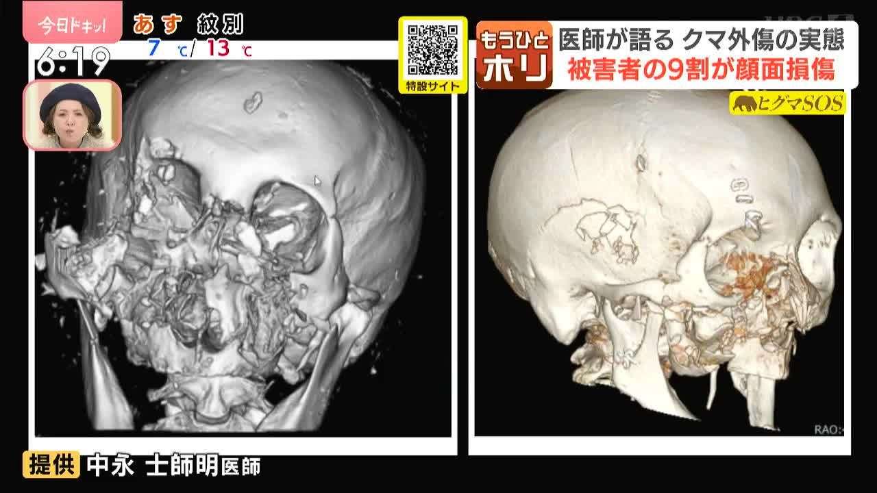 岩手・北上市の山林で発見された遺体は行方不明だった温泉勤務の60歳従業員　クマに襲われ死亡