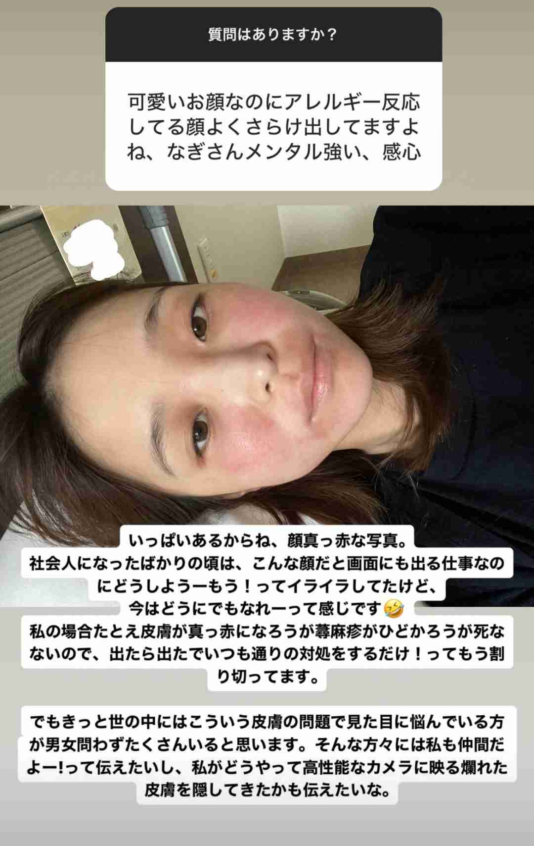 元フジアナ・渡邊渚とNHKの間でトラブル発生「担当ディレクターは休職」密着番組が放送中止になった理由とその裏側