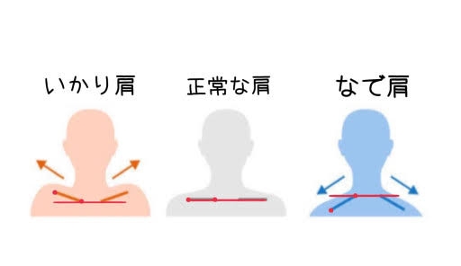 肩ボトックス打ってる方