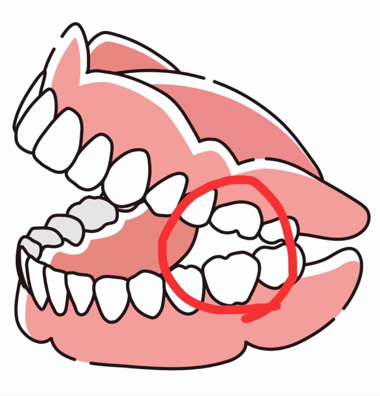 素敵な男性に出逢えたけど歯がない