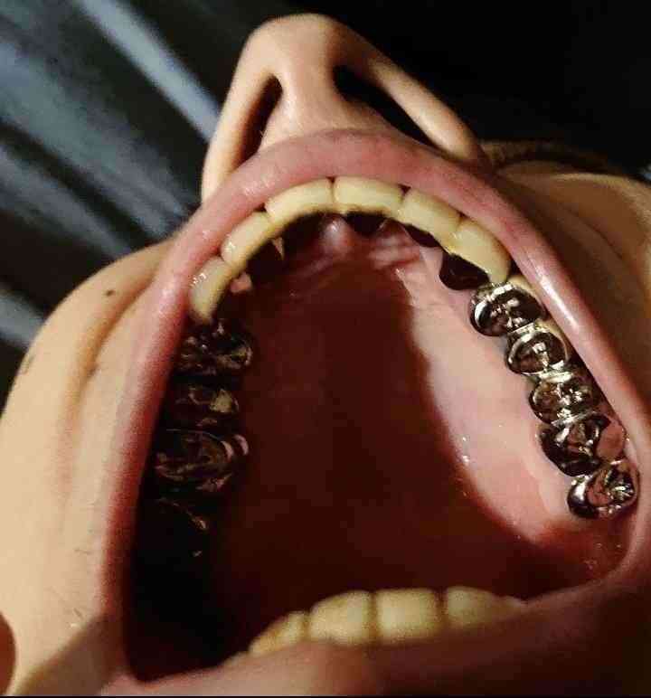 素敵な男性に出逢えたけど歯がない